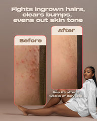 Sugardoh Ingrown Magic Wand: acide glycolique favorise une exfoliation en douceur.