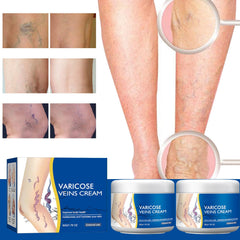 Crème Taduno Varices – absorption rapide apaise les jambes fatiguées.