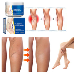 Taduno Varices – peau bien hydratée et confortable après l’application.
