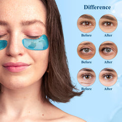 Application confortable des patchs Taimand hydratation ciblée du regard.
