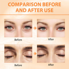 Tbexem Revive Glow zone poches yeux – peut réduire les poches
