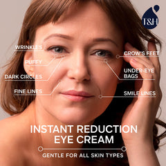 TEREZ & HONOR under-eye area illustration demonstrates subtle lift and brightness.