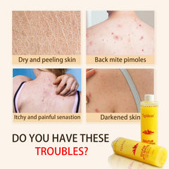 Tgideas Soufre: texture-peau montrant peau plus lisse après l'utilisation.