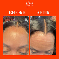 The Frontal Queen – dentelle fondante, maintien longue durée pour une coiffure stable