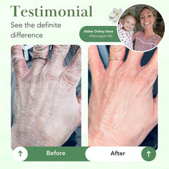 Theraplex Crème Barrière – formule sans parfum adaptée aux peaux sensibles.