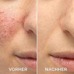 THUIOP sérum vitamine C — teint plus lumineux et éclat naturel.