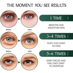 Tiepetly outil-cuillere pour retirer les patches facilement.