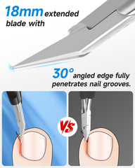 Coupe-ongles Tisojpod pour ongles incarnés avec précision.