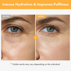TOSOWOONG Vita Clinic hyaluronique apporte une hydratation durable autour des yeux.