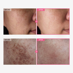 Textured crème TOSOWOONG légère et rapidement absorbée sur peau