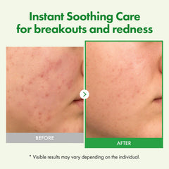 Crème hydratante profonde pour peau sensible et sèche.