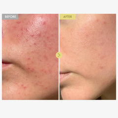 TOSOWOONG Crème Mucin Noir 92 texture gel legere, application rapide.