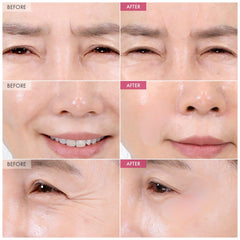 Patchs yeux TOSOWOONG ciblant les ridules autour des yeux pour un regard frais.