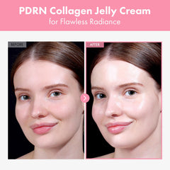 PDRN collagène gelée-crème, hydrolysé pour meilleure absorption et fermeté.