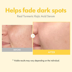 TOSOWOONG Real Turmeric Serum: alpha-arbutine pour le teint homogène.