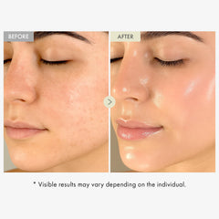 Sérum TOSOWOONG Real Collagen Visage, absorption rapide, peau mieux hydratée et lisse.