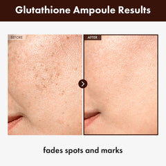 Goutteur précis du sérum glutathion 20000ppm pour une application maîtrisée.