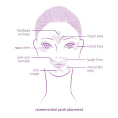 Patch Y-shapes Toute Nuit, couverture ciblée des zones critiques