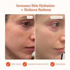 Tower 28 SOS Recovery Crème avec acide hyaluronique pour hydratation en profondeur