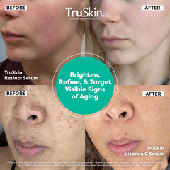TruSkin rétinol – goutte le soir, peut améliorer la texture de la peau.