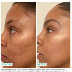 Mousse crémeuse produite par la barre Urban Skin Rx Even Tone pour nettoyage quotidien