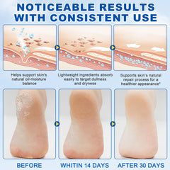 Urée-pieds-stick : texture dense qui pénètre sans laisser de résidu.