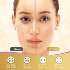 USTELIR patches yeux acide hyaluronique: atténuer les rides et repulper légèrement le contour