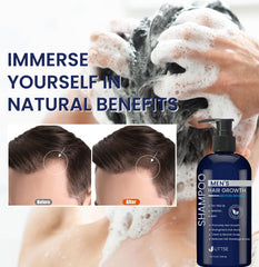 Uttse Shampoing Biotine: soulage cuir chevelu et favorise une croissance saine.