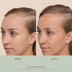 VEGAMOUR GRO+ – Application sur cuir chevelu avec exfoliation légère.