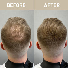 VOLLUCK fibres application rapide pour démarrage facile sur tous les cheveux.