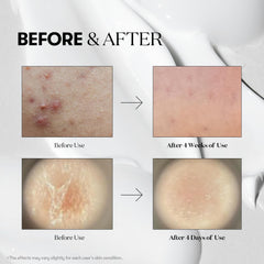 VT COSMETICS Reedle Shot 300 en flacon, absorption en profondeur.