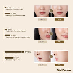 Wellderma micro-hole hydrogel sheet design improves adherence and comfort.
