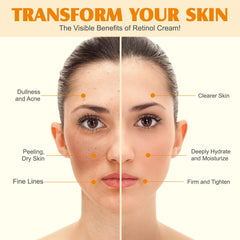 WLCTJIAYOU miel-baume-visage : douceur nourrissante pour peaux irritées.