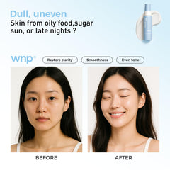 WNP avec Niacinamide 2% et 377 unifie le teint.
