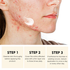 YAFUSIPE Exfoliation douce acne visage pour peau lisse.