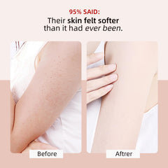 Pré-rasage doux avec YAFUSIPE KP Bump Eraser sur peau préparée