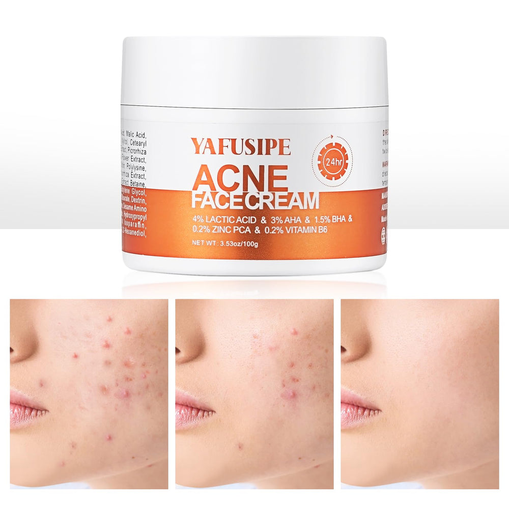 YAFUSIPE Soin acne visage: visage clair et zones ciblées.