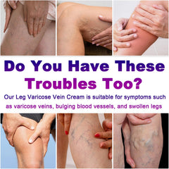 Application de Yongsenina Varices sur les jambes pour un soulagement doux.