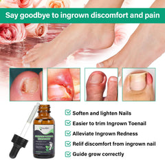 YOUVLAN outil soulève-ongle incarné en acier inoxydable – usage sûr.