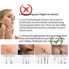 YOUYISI pince-extracteur de point noir, précision pour un soin ciblé.