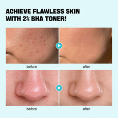 ZealSea Exfoliant BHA, texture satinée, révèle une peau plus lisse et lumineuse.