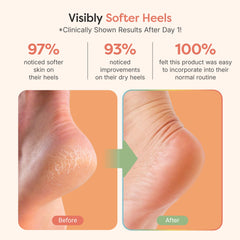 Embllage cadeau ZenToes prêt à offrir pour le soin des pieds.