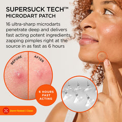 ZitSticka Killa Mini microdarts ultra-fins pour une action ciblée.