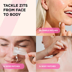 Patchs Goo Getter ZitSticka pour visage, lutte contre les boutons.