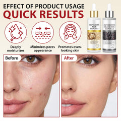 Ampoules douces ZIXAOK, application rapide pour lisser et hydrater.