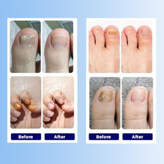 Patchs Aedydyce ongles : port nocturne jusqu’à huit heures.