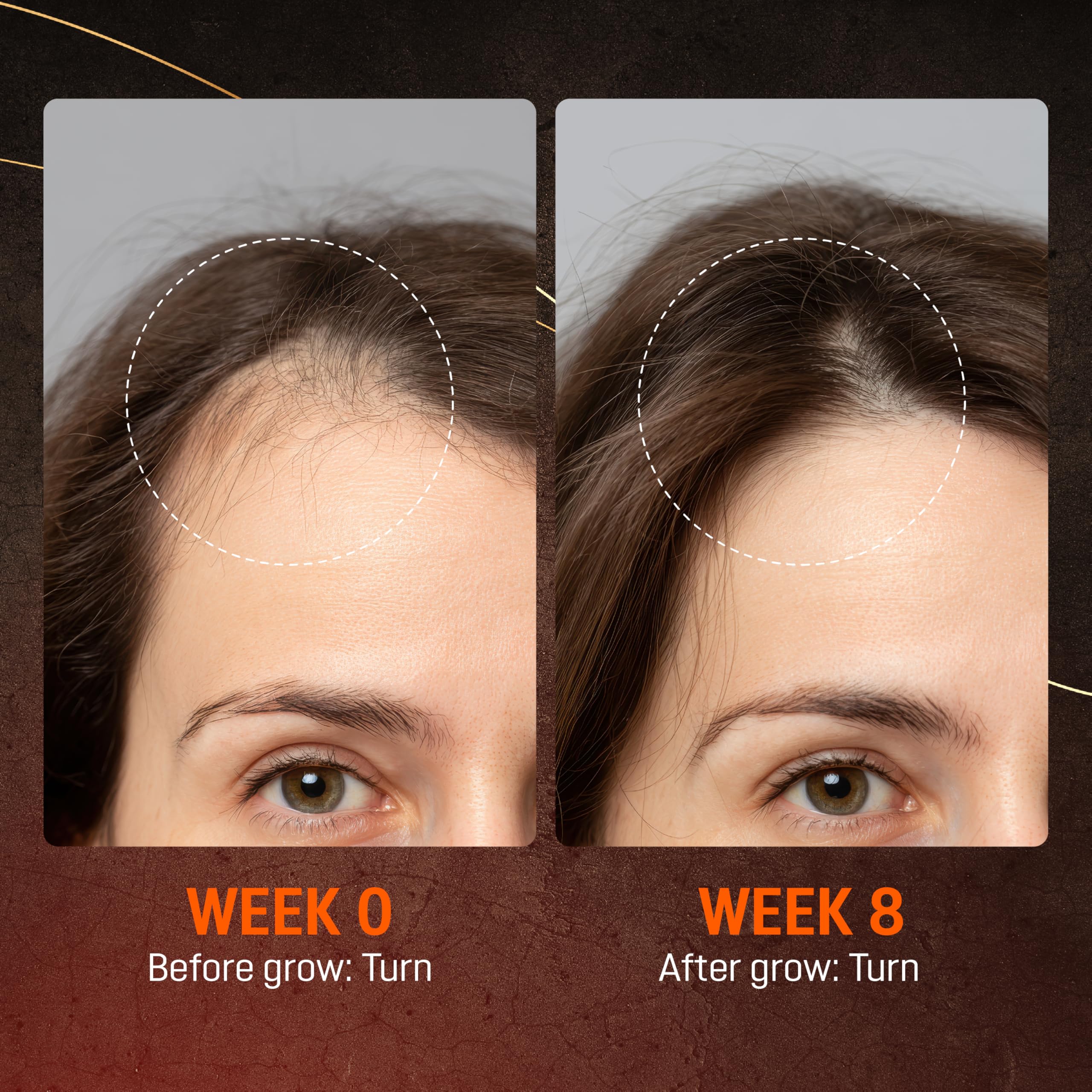Avant/après: cheveux plus épais avec Abera.