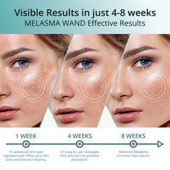 Emballage élégant ABERA Melasma Serum Plus prêt à être posé sur la coiffeuse.