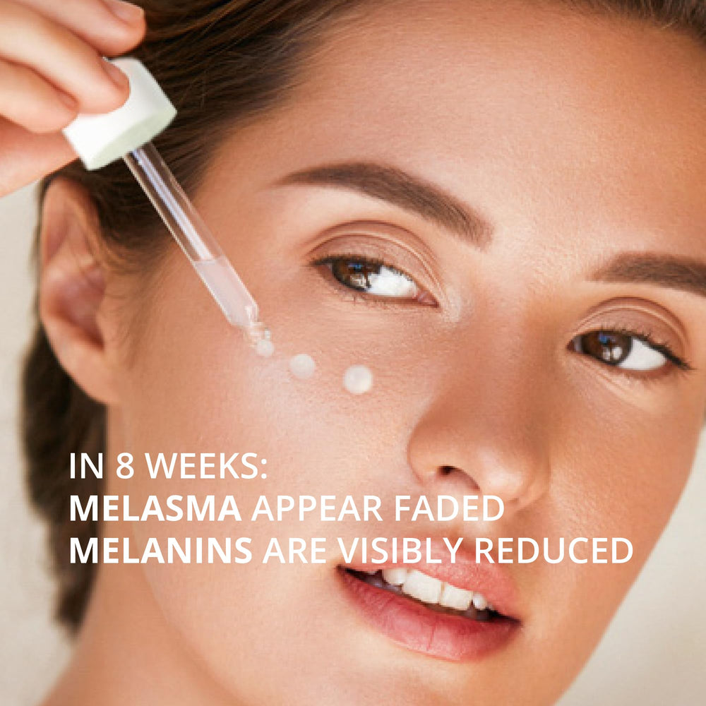 ABERA Melasma Serum Plus—idéal après exposition solaire pour prévenir les taches.