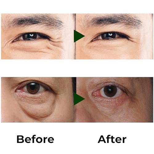 ABERA roll-on yeux pour homme, application rapide et sans résidu.